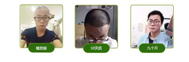 77.png